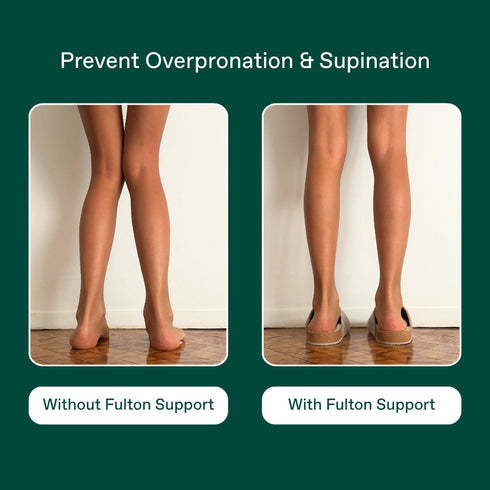Supplier support comparison diagram on a green background