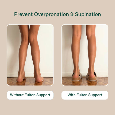 Supplier comparison illustration of feet with and without Fulton support
